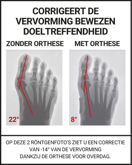 CORRIGEERT DE VERVORMING BEWEZEN DOELTREFFENDHEID