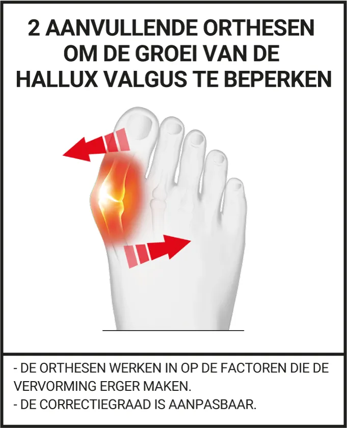 2 AANVULLENDE ORTHESEN OM DE GROEI VAN DE HALLUX VALGUS TE BEPERKEN