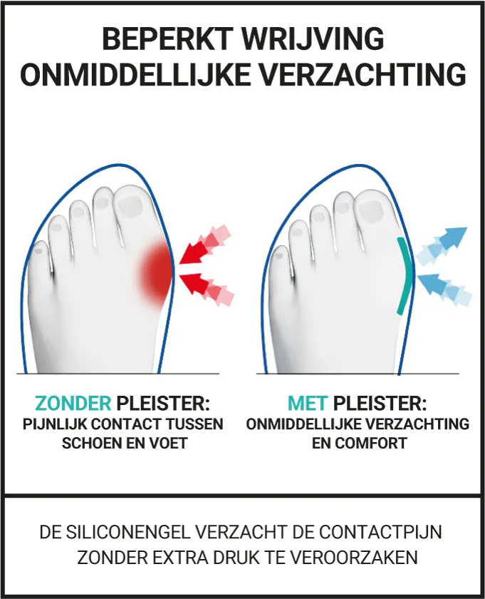 BEPERKT WRIJVING ONMIDDELLIJKE VERZACHTING