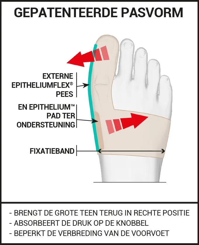 ORTHESE VOOR OVERDAG GEPATENTEERDE PASVORM