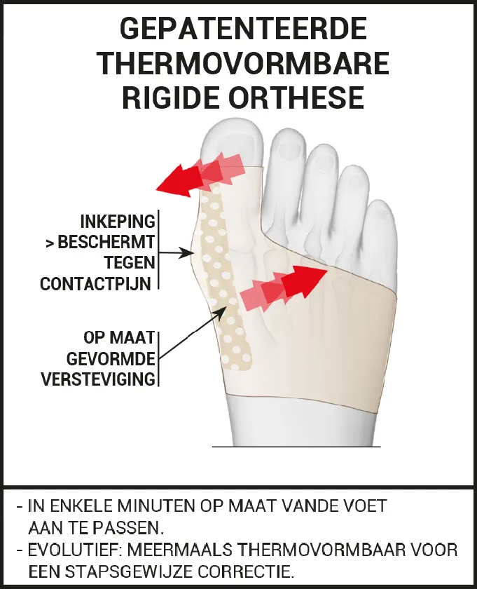 RIGIDE EN THERMOVORMBARE ORTHESE VOOR ’S NACHTS