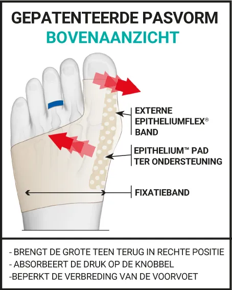 CORRIGERENDE HALLUX VALGUS ORTHESE MET DUBBELE WERKING