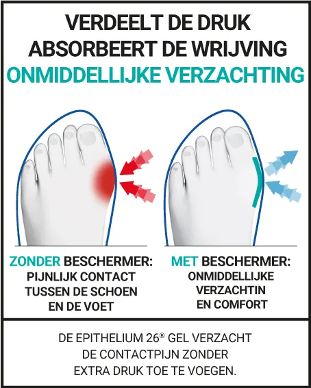 Hallux Valgus "knobbel" Beschermer